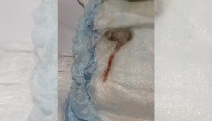 Rato encontrado em fralda de bebê no Rio. Foto: Marina Sobral/ Arquivo pessoal/R7