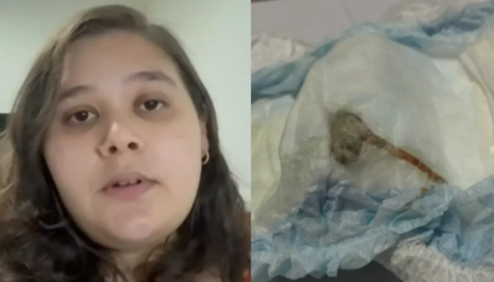 rato-fralda